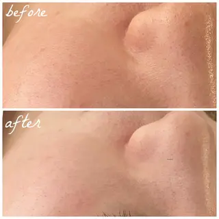 メンズ メナード岐阜茜部 杉浦のエステ・リラクイメージ