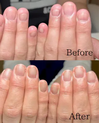 ネイル 深爪・自爪育成専門 MAHALOHIのネイルデザイン