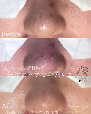 シードリン 府内店 小波のエステ・リラクイメージ