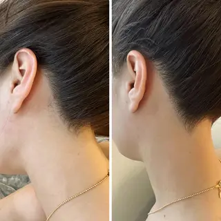 うなじ脱毛/美肌脱毛 LABELのエステ・リラクイメージ