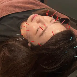 小林整骨院玉川 キジマのエステ・リラクイメージ