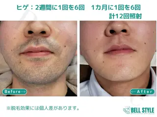 メンズ 【脱毛・美肌専門】メンズ&レディースサロンBell style所属・【脱毛・美肌専門】 bellstyleのエステ・リラクイメージ