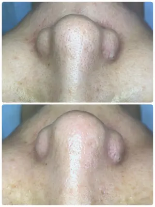 ピーリング専門サロン Spicaのエステ・リラクイメージ