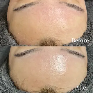 ๐๐๐๐ก๐ ๐๐ฒ ๐๐๐ฒ๐ฎๆๅฑใปใใผใใใผใชใณใฐ๐ฟ ๐ด๐๐๐ใฎใจในใใปใชใฉใฏใคใกใผใธ