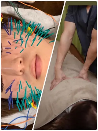 表参道鍼灸院K 美容鍼🔮ララピールのエステ・リラクイメージ