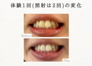 セルフホワイトニングエクシア小山店所属・セルフホワイトニング エクシア小山店のその他イメージ