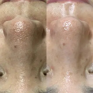 Chio-RE所属・Wax/絹肌艶肌🌼 坂結加のエステ・リラクイメージ