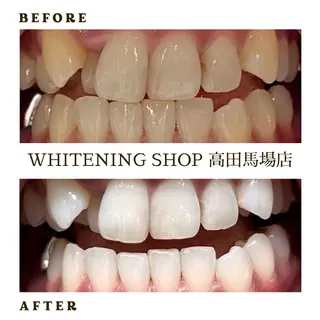 メンズ ホワイトニング ショップ高田馬場店のその他イメージ