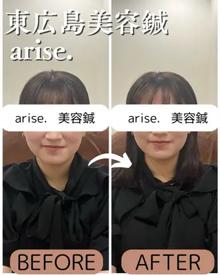arise.所属・東広島美容鍼 /arise.のその他イメージ