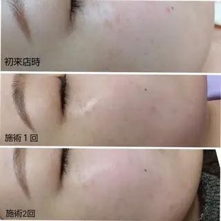 シミケア専門店 HAQUAのその他イメージ