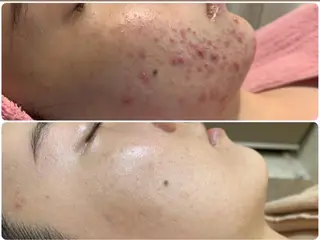 フェイシャル/脱毛 ジョアアンジェ景山のエステ・リラクイメージ