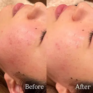 Hari Lounge恵比寿所属・chika🦋 ハリラウンジ恵比寿のエステ・リラクイメージ