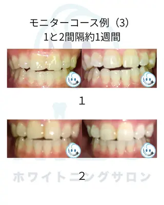ミディアム パーマ ホワイトニングサロン nico西葛西店のその他イメージ