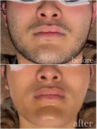 メンズ BEACH（脱毛サロンECXIA内）所属・博多エステティシャン SHINYAのエステ・リラクイメージ