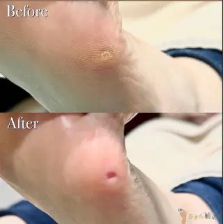 川崎巻き爪補正店所属・巻き爪アカデミー 溝の口のネイルデザイン