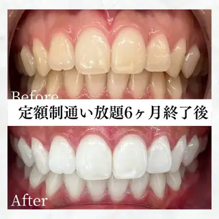 メンズ セルフホワイトニング WHITE福岡博多店のエステ・リラクイメージ