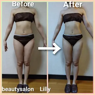 beautysalon Lily所属・Yamaguchi Erikaのエステ・リラクイメージ