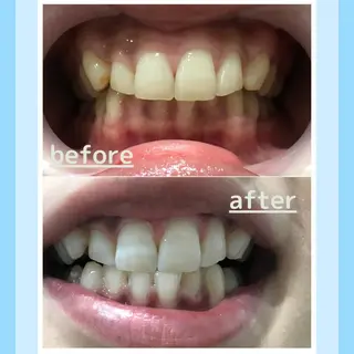 メンズ お手軽ホワイトニングsalon mina所属・武元 奈津美のその他イメージ