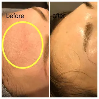 カラー パーマ ヘアアレンジ ネイル マツエク・マツパ アイブロウ SALON SINCERITEのエステ・リラクイメージ