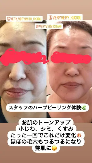 VERY VERY九条店所属・VERY VERY 九条店のエステ・リラクイメージ