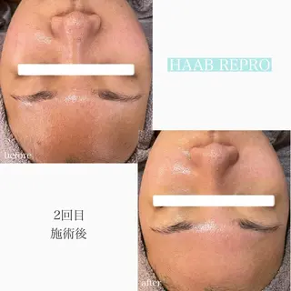 1ヶ月後も半分残る 高持続LEDエクステのマツエク・マツパデザイン