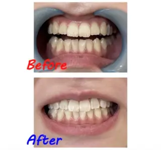 セルフホワイトニングサロン　ラヴィアン所属・ホワイトニングサロン La vie enのその他イメージ