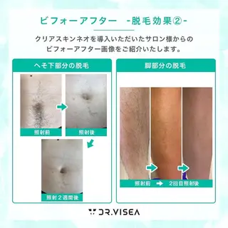 メンズ メンズサロンGRACE所属・salon GRACEのエステ・リラクイメージ