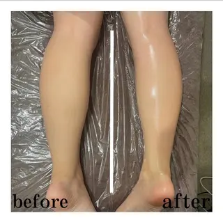 mimosa心斎橋所属・山﨑 諒のエステ・リラクイメージ