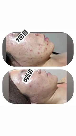 【足圧】鬼👹リンパ 身体整うサロンのエステ・リラクイメージ