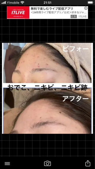 ショート カラー パーマ ヘアアレンジ メンズ キッズ ネイル マツエク・マツパ アイブロウ ハーブピーリング専門 🌿モッカのエステ・リラクイメージ