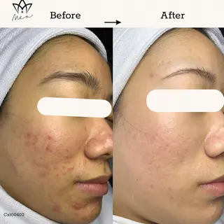 Mia beauty所属・MiA Beautyのエステ・リラクイメージ