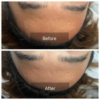 肌質改善サロン facialmoonのエステ・リラクイメージ