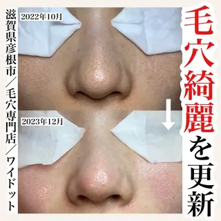 Ydot. 池内 友架のエステ・リラクイメージ