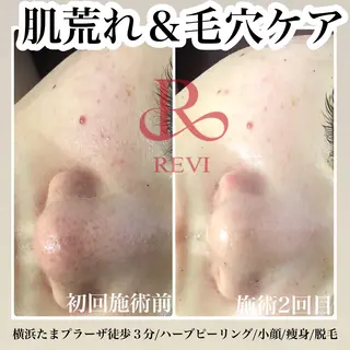 LILIANA所属・LILIANA ☆YURIのエステ・リラクイメージ