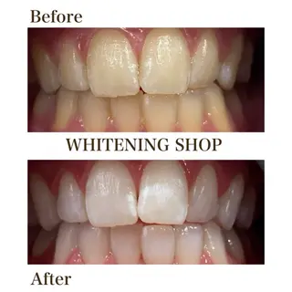 ホワイトニングショップ　四条店所属・ホワイトニング ショップ 四条店のエステ・リラクイメージ