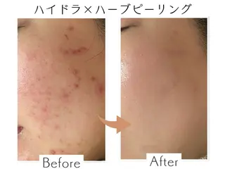 プライベートサロン Belle（ベル）のエステ・リラクイメージ