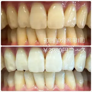 PLATINUM Beauty 横浜店所属・ホワイトニングルーム 横浜店のその他イメージ