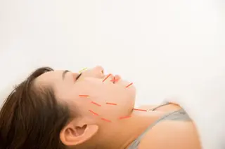 鍼ボディケア＋美顔鍼 IMOTOのエステ・リラクイメージ