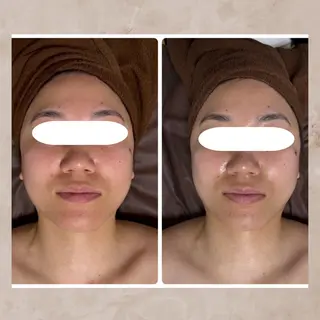 Total Beauty Salon Vi's CLUB by BINEL所属・Vi's CLUB KOTONOのエステ・リラクイメージ