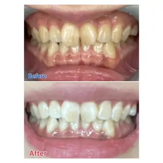 MBEAUTYSALON 千葉店・京成大久保所属・Melty 輝のその他イメージ