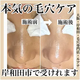 マツヤニWax専門/ 岸和田/Luanaのエステ・リラクイメージ