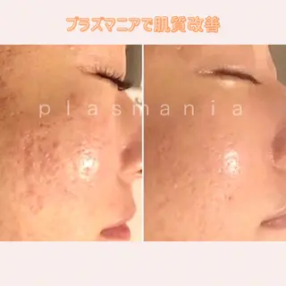 肌管理エステサロン｜ Connect ゆいのエステ・リラクイメージ