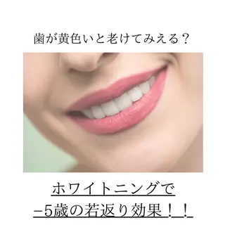 ホワイトニングショップ津店所属・ホワイトニング ショップ津店のその他イメージ