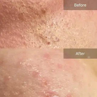 Mandarin Orange所属・毛穴から始める肌メン テマンダリンオレンジのエステ・リラクイメージ