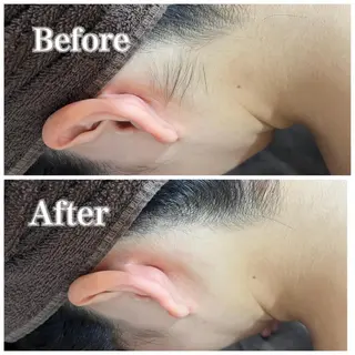 脱毛サロン fam.豊澤柚良のエステ・リラクイメージ