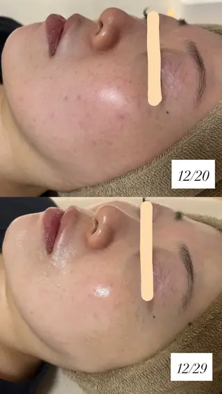 salon More所属・出口 玲菜のエステ・リラクイメージ