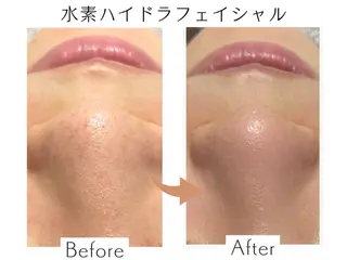 プライベートサロン Belle(ベル)のエステ・リラクイメージ