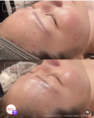 YUIITSU所属・YUIITSU 小顔コルギのエステ・リラクイメージ