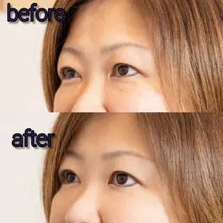 北梅田美容鍼灸院所属・美容鍼マイスター 川村　淳のエステ・リラクイメージ