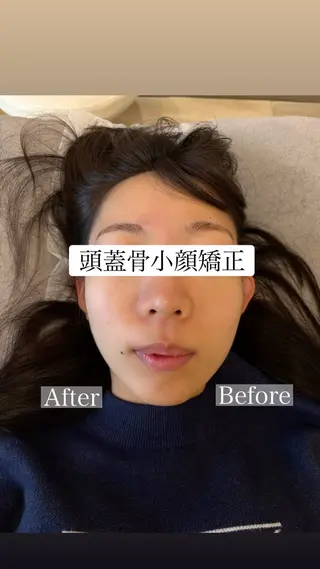 Top Face立川 【小顔矯正】小川のエステ・リラクイメージ